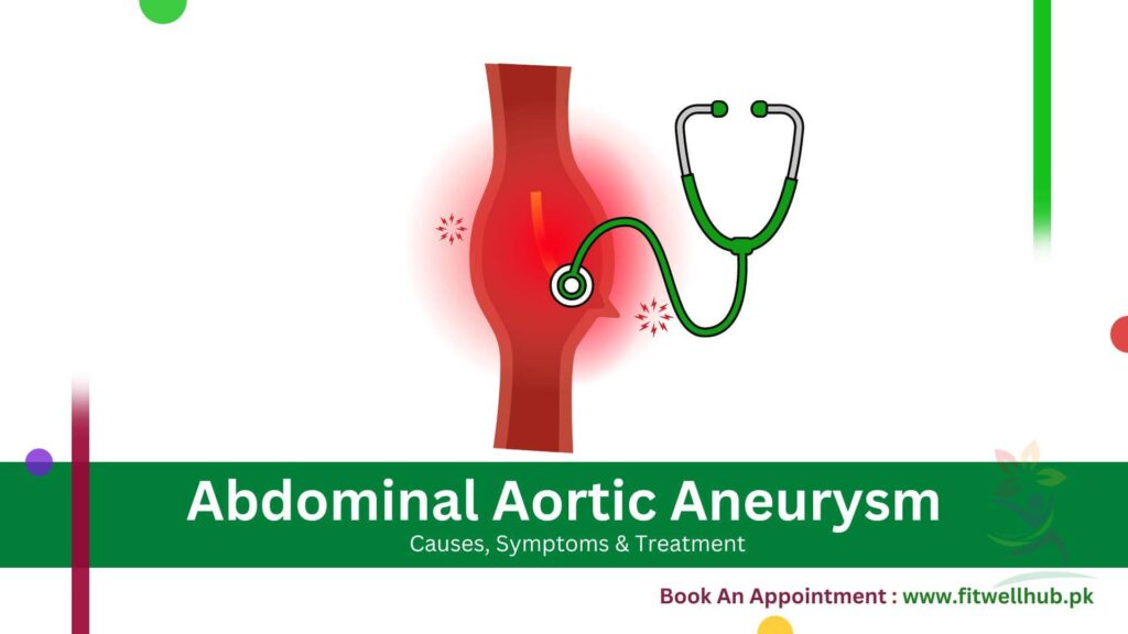 Abdominal Aortic Aneurysm