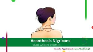 Acanthosis Nigricans on neck