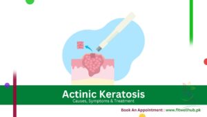 Actinic Keratosis causes, treatment, home remedies and more