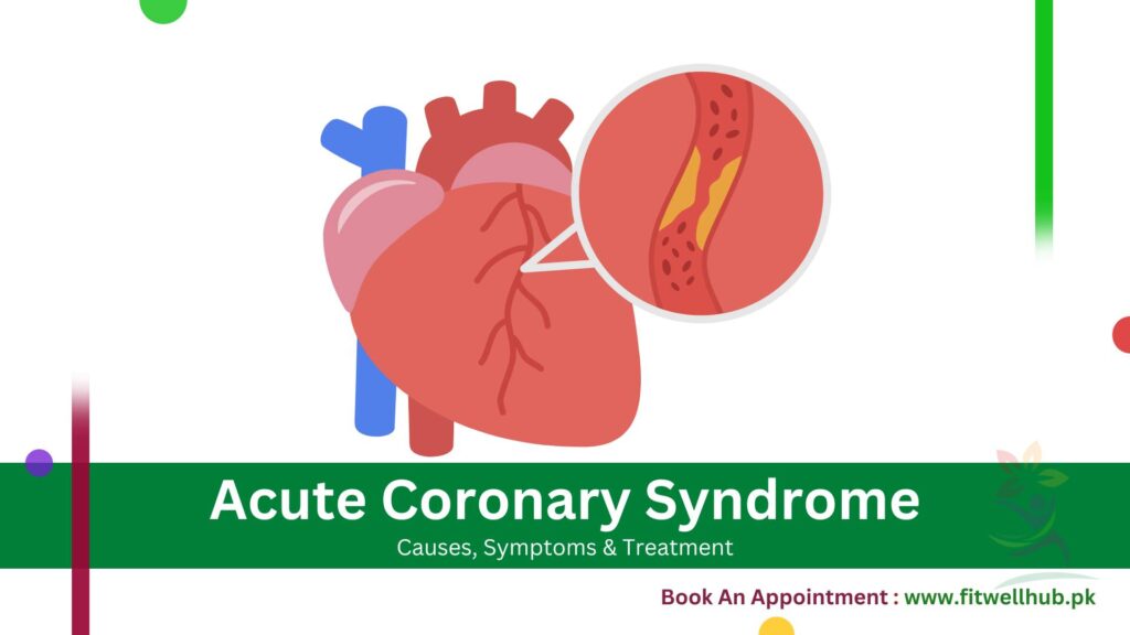 Complete Guide Of Acute Coronary Syndrome (ACS)