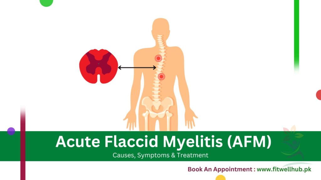 Complete Guide Of Acute Flaccid Myelitis (AFM)