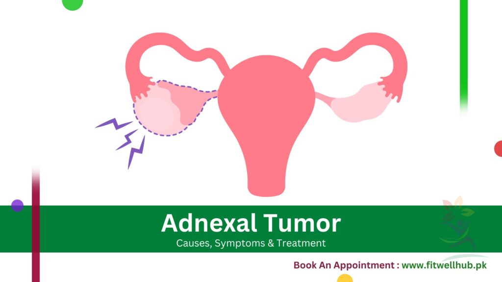 symptoms of Adnexal Tumors