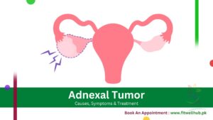 symptoms of Adnexal Tumors