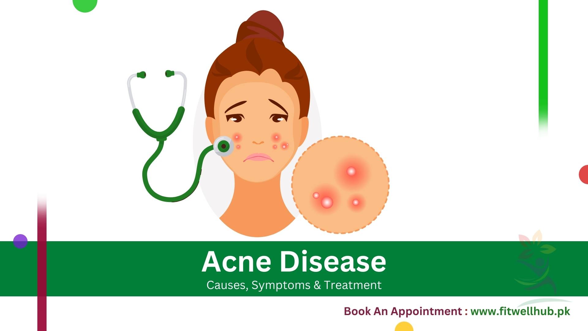 Showcasing acne on the face