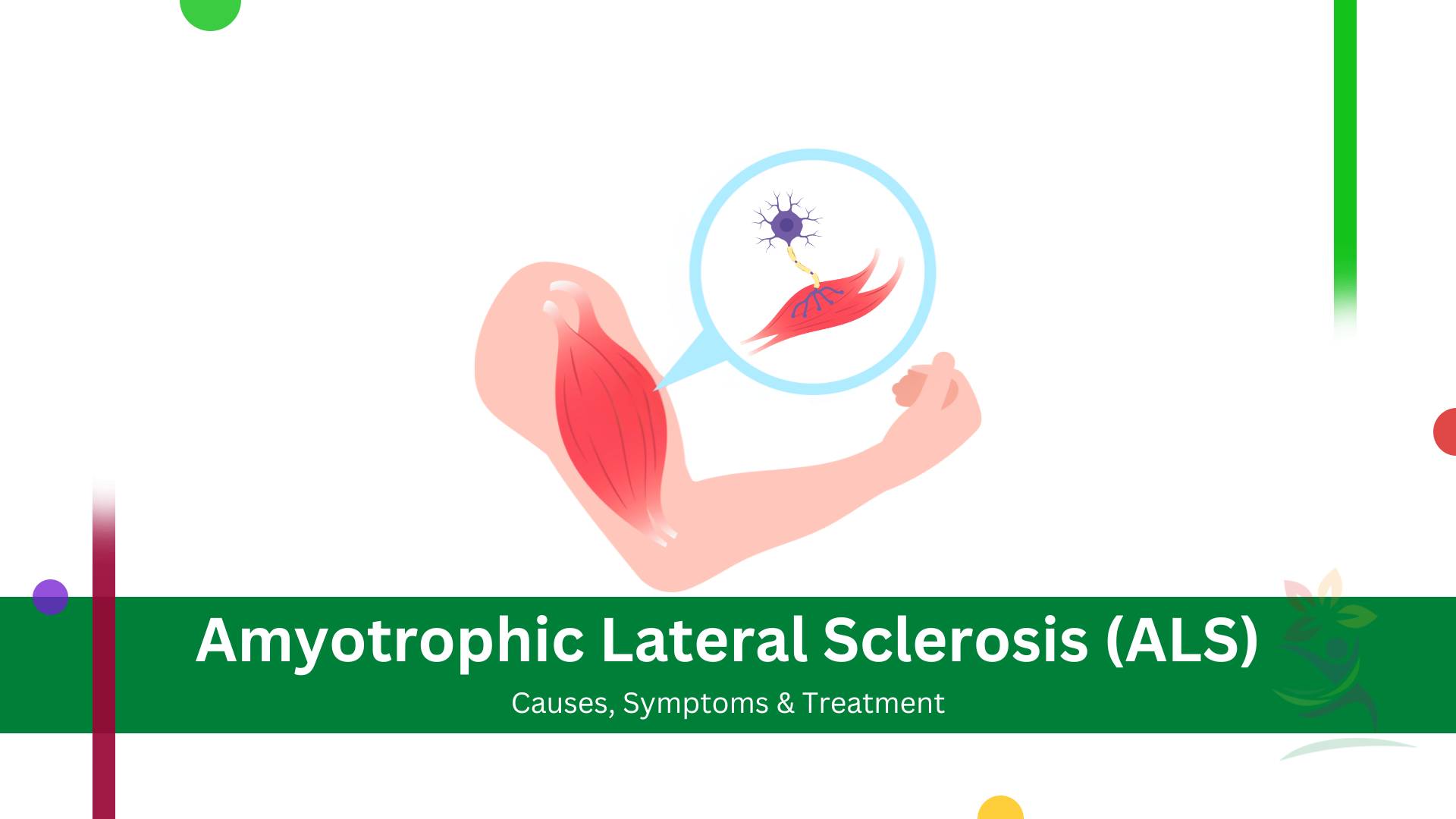 Amyotrophic Lateral Sclerosis (ALS)