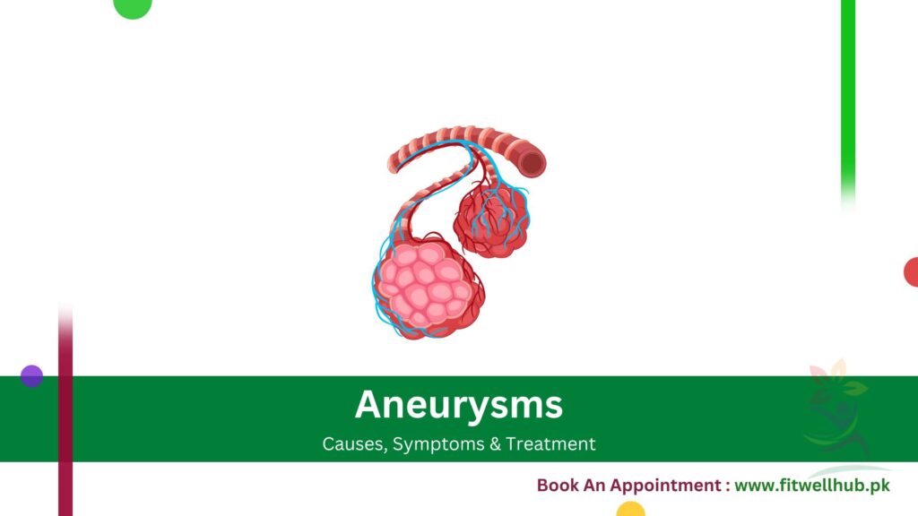 Aneurysms | Symptoms, Causes and Treatment Guide