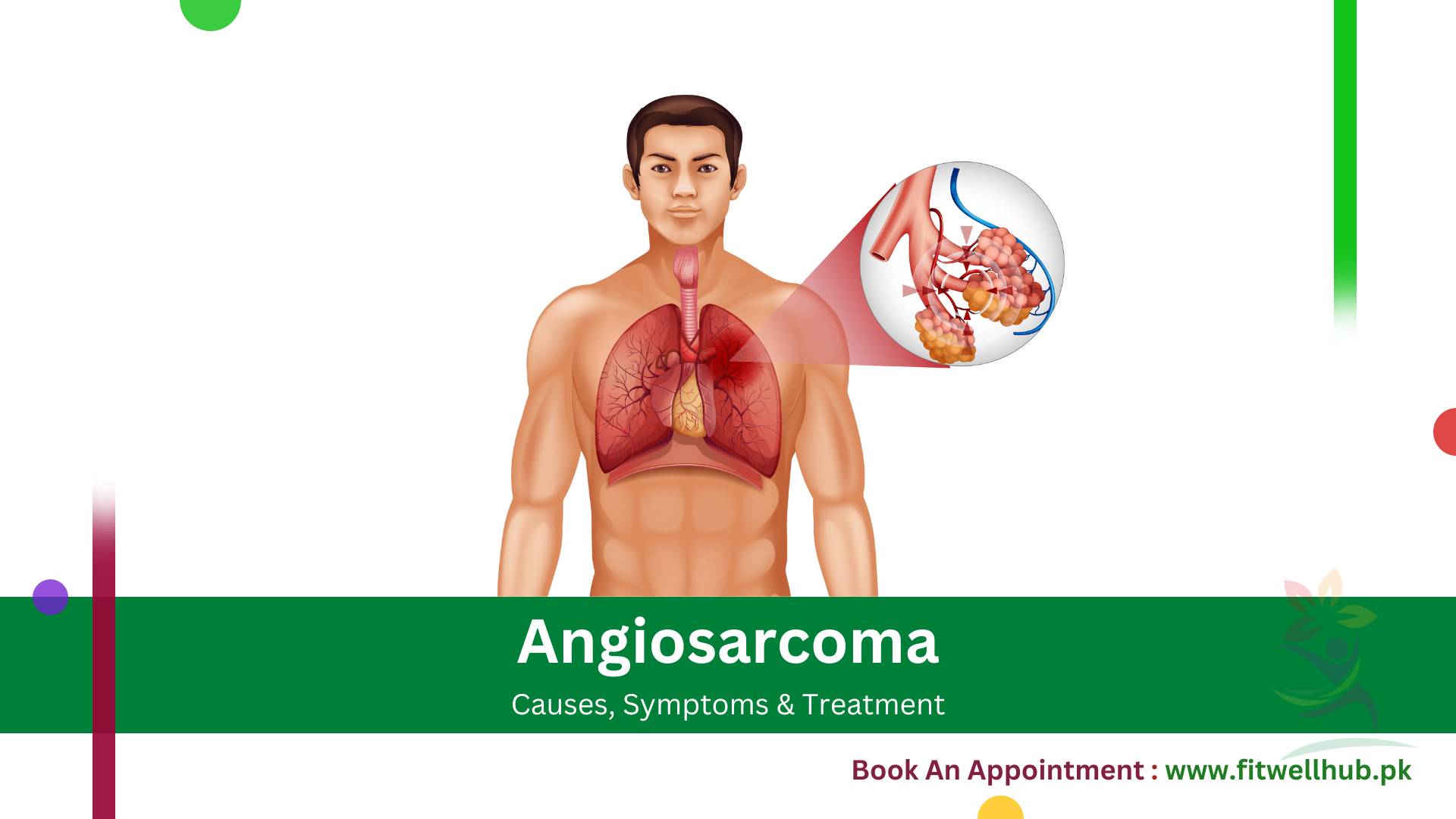 Angiosarcoma | Symptoms, Causes and Treatment Guide