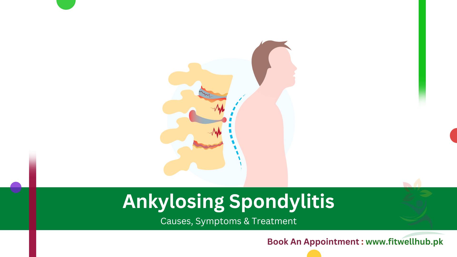 Ankylosing Spondylitis symptoms