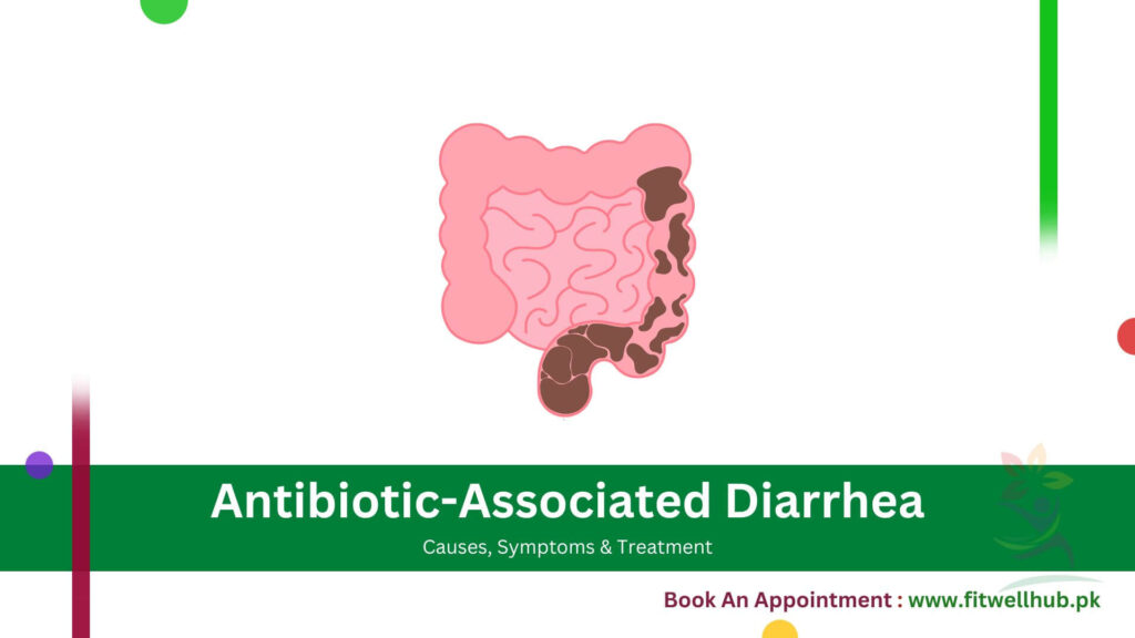 Visualize Antibiotic-Associated Diarrhea