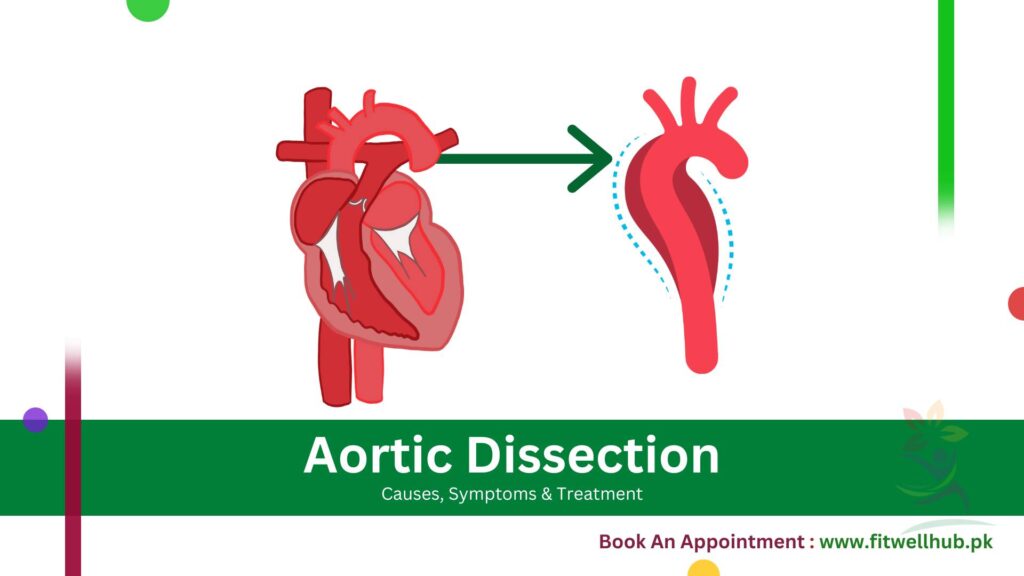 Full Guide Aortic Dissection Causes, Symptoms & Treatment