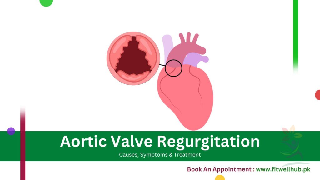 Aortic Valve Regurgitation Causes, Symptoms & Treatment