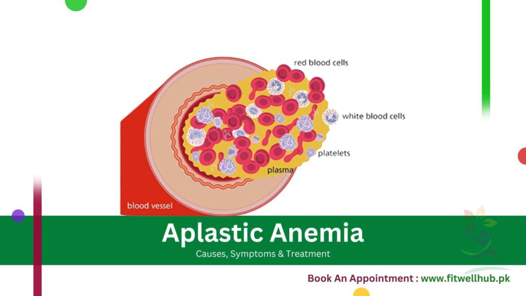 Aplastic Anemia Symptoms, Causes and Treatment