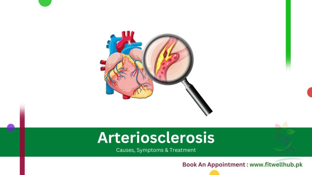 Arteriosclerosis Guide | Causes, Symptoms & Treatment