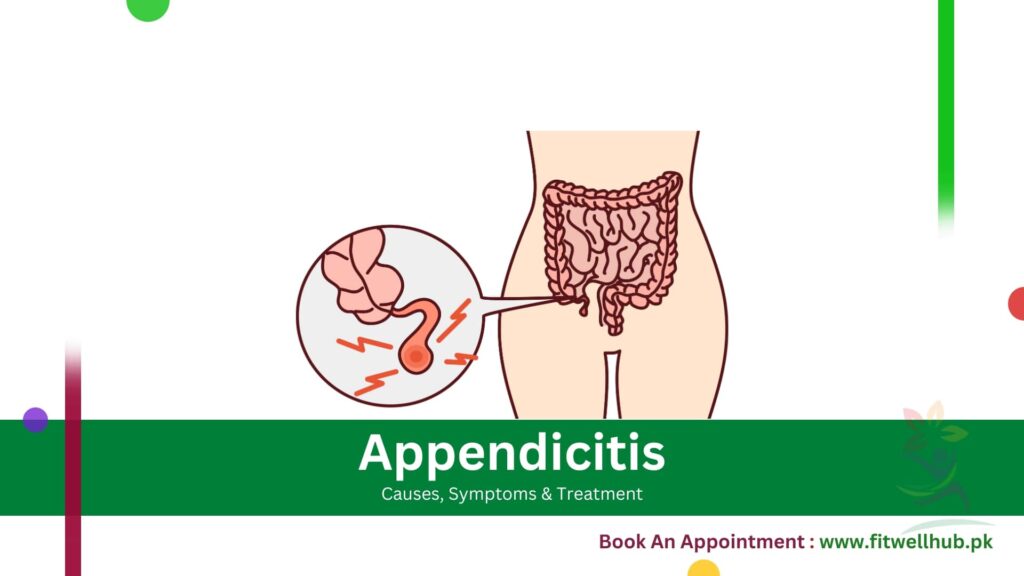 Appendicitis Causes, Symptoms and Treatment Guide