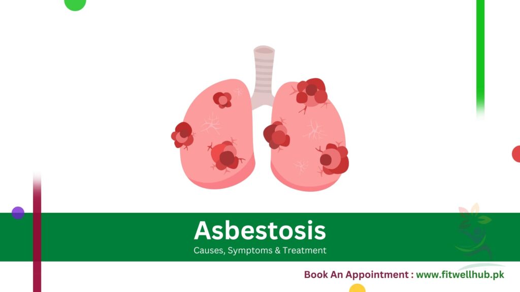 Asbestosis Symptoms, Causes and Treatment Guide