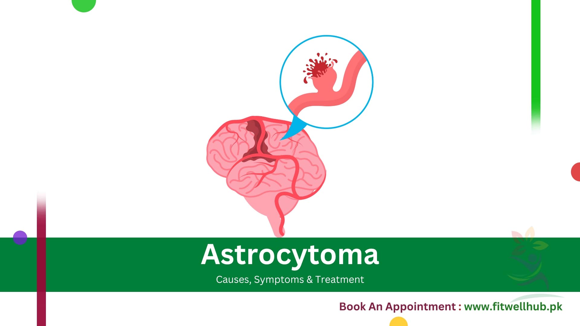 Astrocytoma Symptoms, Causes and Treatment Guide