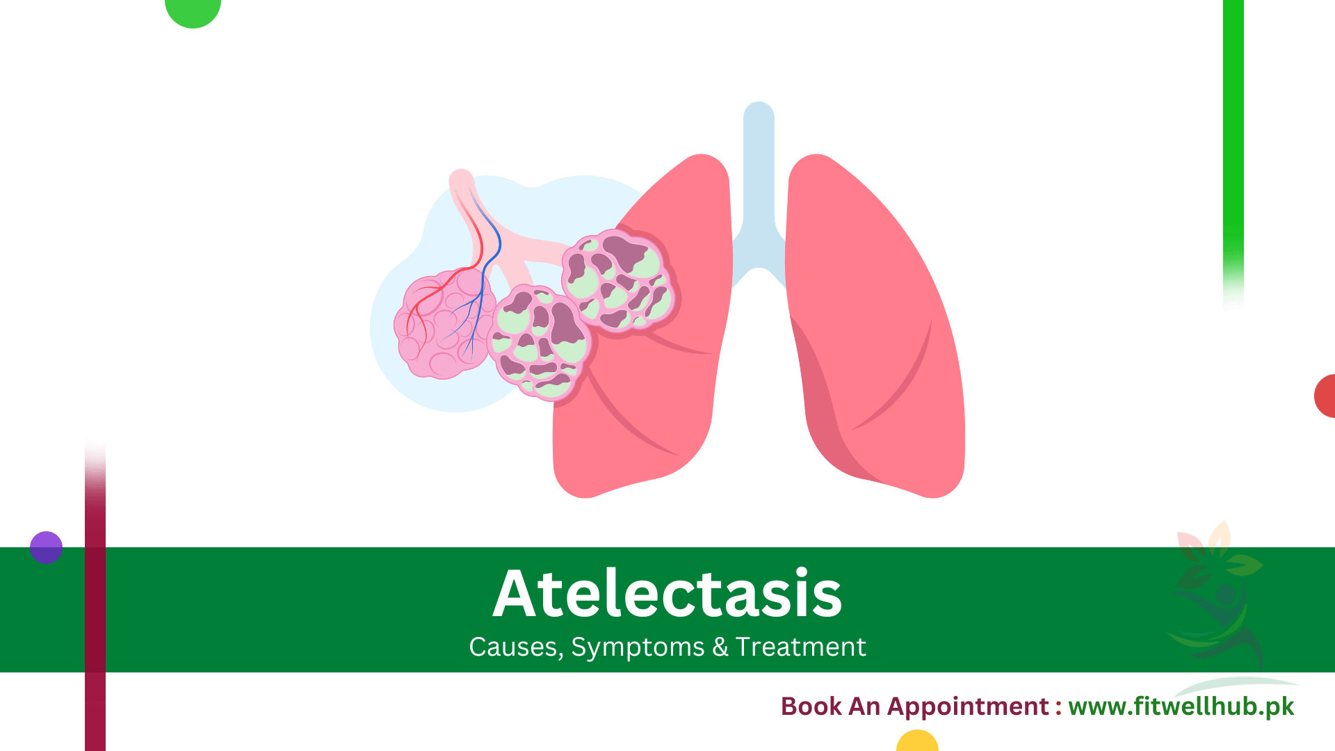 Atelectasis | Causes, Symptoms and Treatment Guide